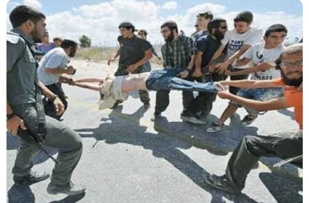 صورة قديمة لمستوطن وليست لطفل فلسطيني
