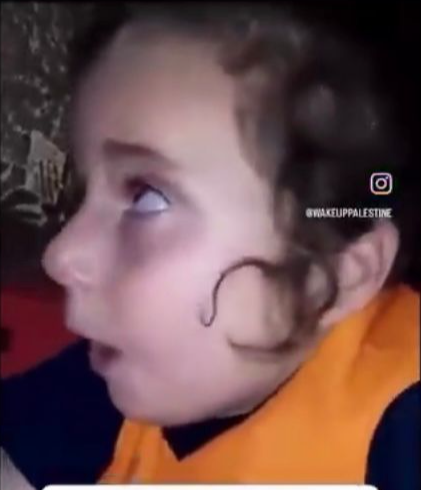الطفلة غفران العليوي  ليست من قطاع  غزة