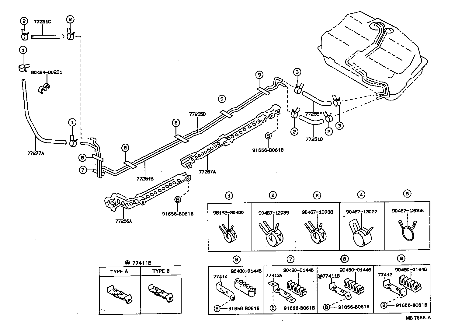 Figure MBT556A