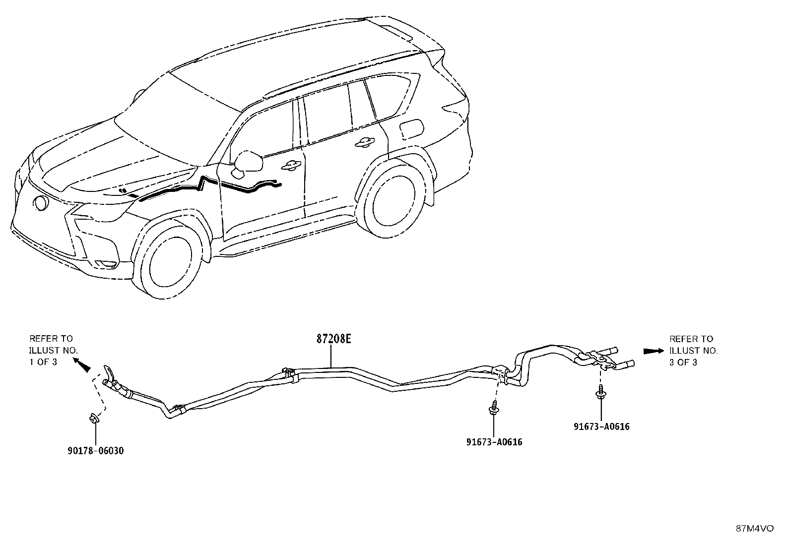 Figure 87M4VO