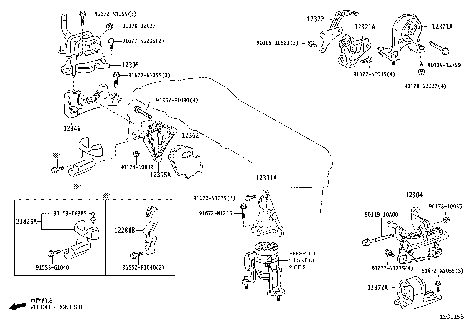 Figure 11G115B