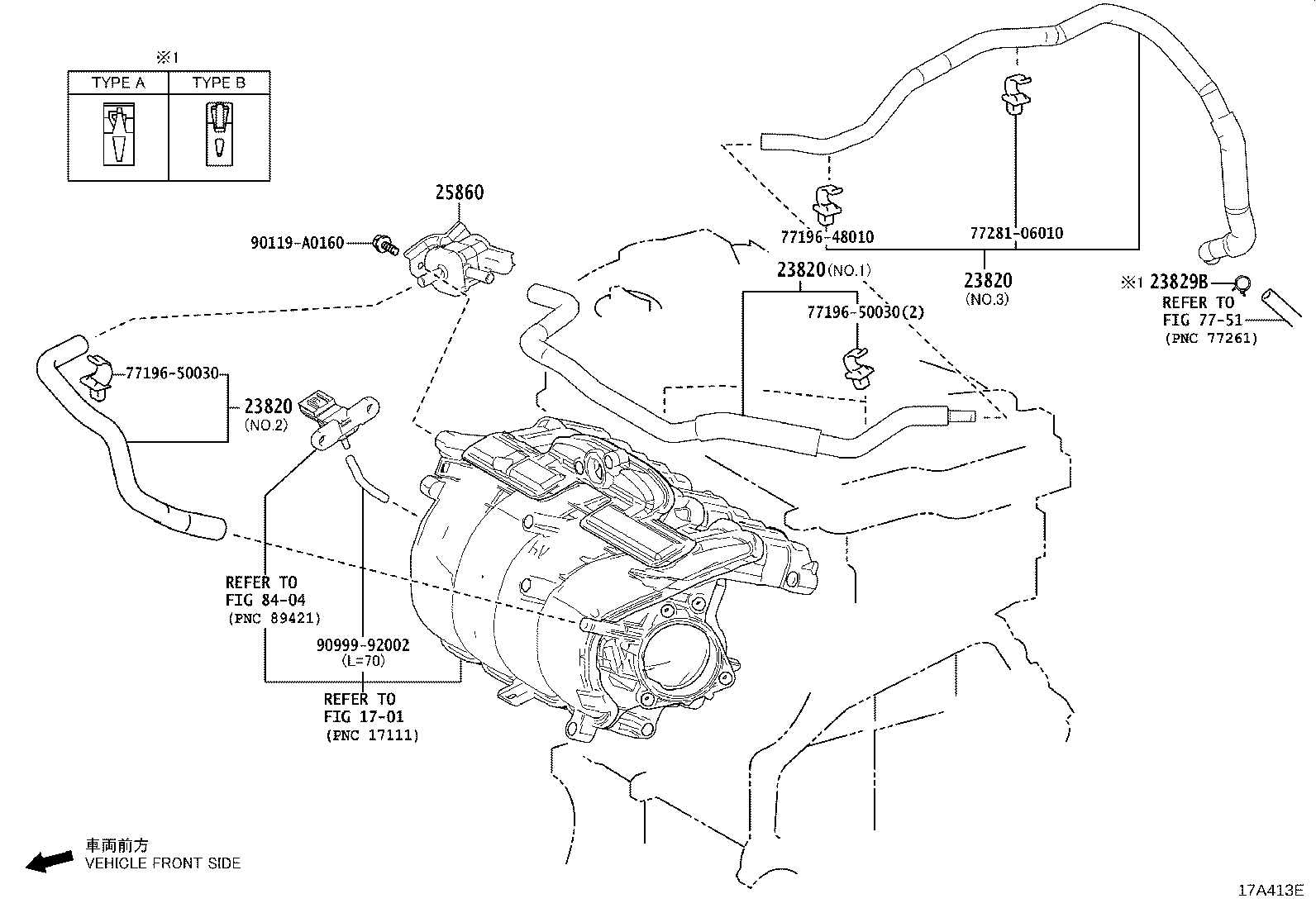 Figure 17A413E