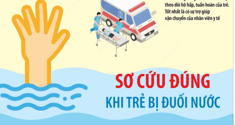 Sơ cứu đúng khi trẻ bị đuối nước