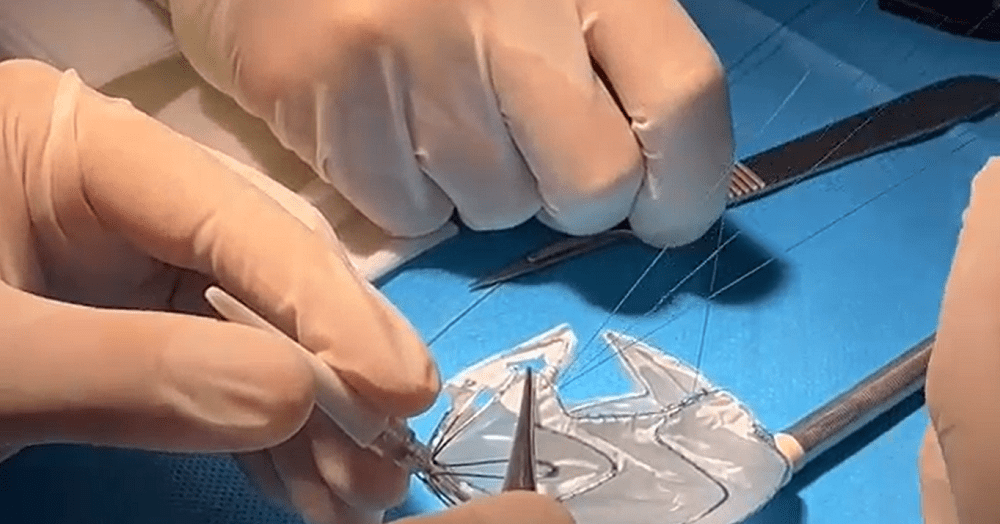 Vinmec áp dụng công nghệ 3D hỗ trợ can thiệp tim mạch lần đầu tiên ở Đông Nam Á