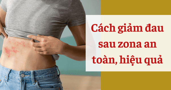 Đau sau zona và cách giảm đau an toàn, hiệu quả nhờ Bách Thống Vương