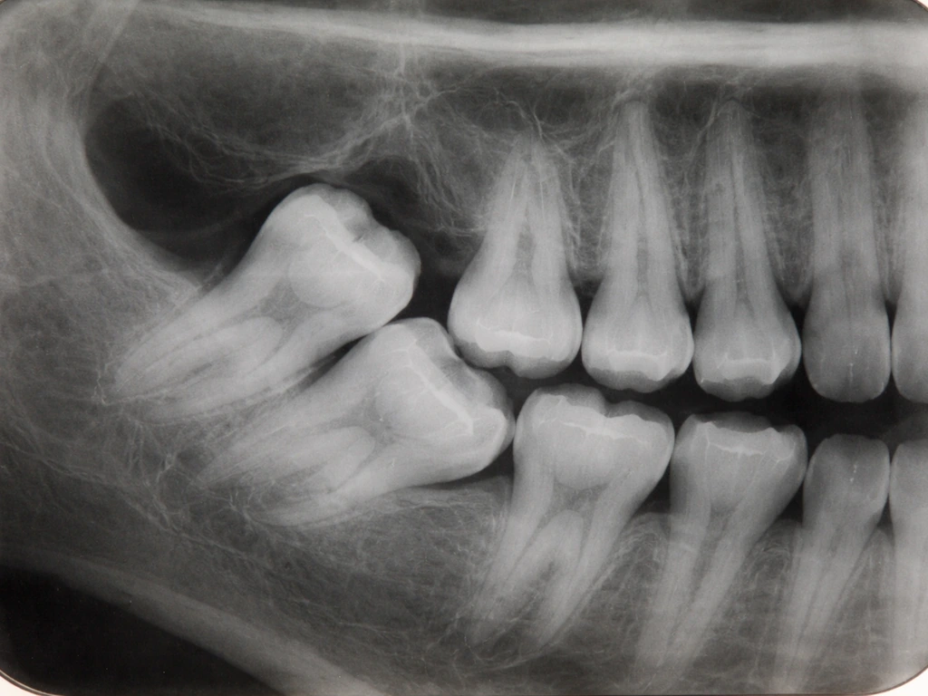 Weird Places Teeth Can Grow: Causes, Signs, and Next Steps