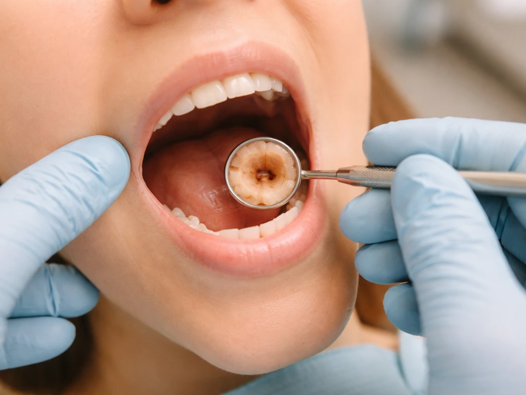 Close-up of a clinician’s gloved hands examining a clean, exposed dental socket area after extraction.