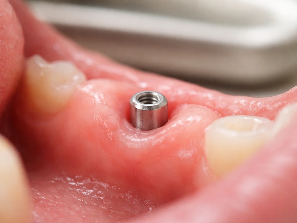 do gums grow over implants