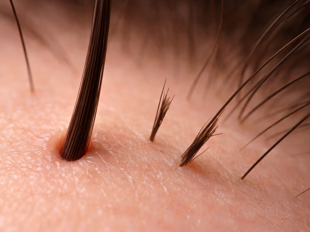 Close-up of scalp hair strands showing longer growth at the follicle and shorter, broken ends.