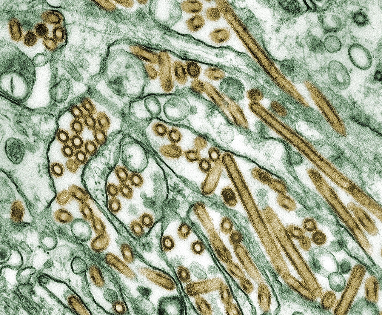 Is There Bird Flu in California Now? Cases, Locations, What to Do