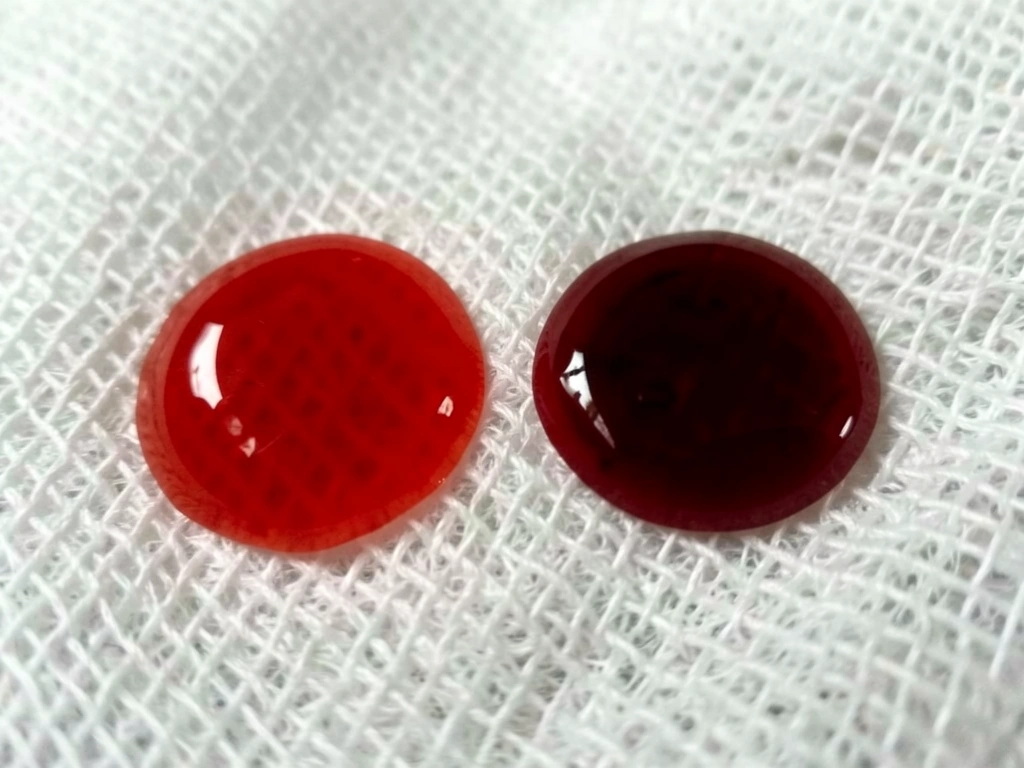 Cherry-red arterial blood compared with darker venous blood on a clean gauze swab