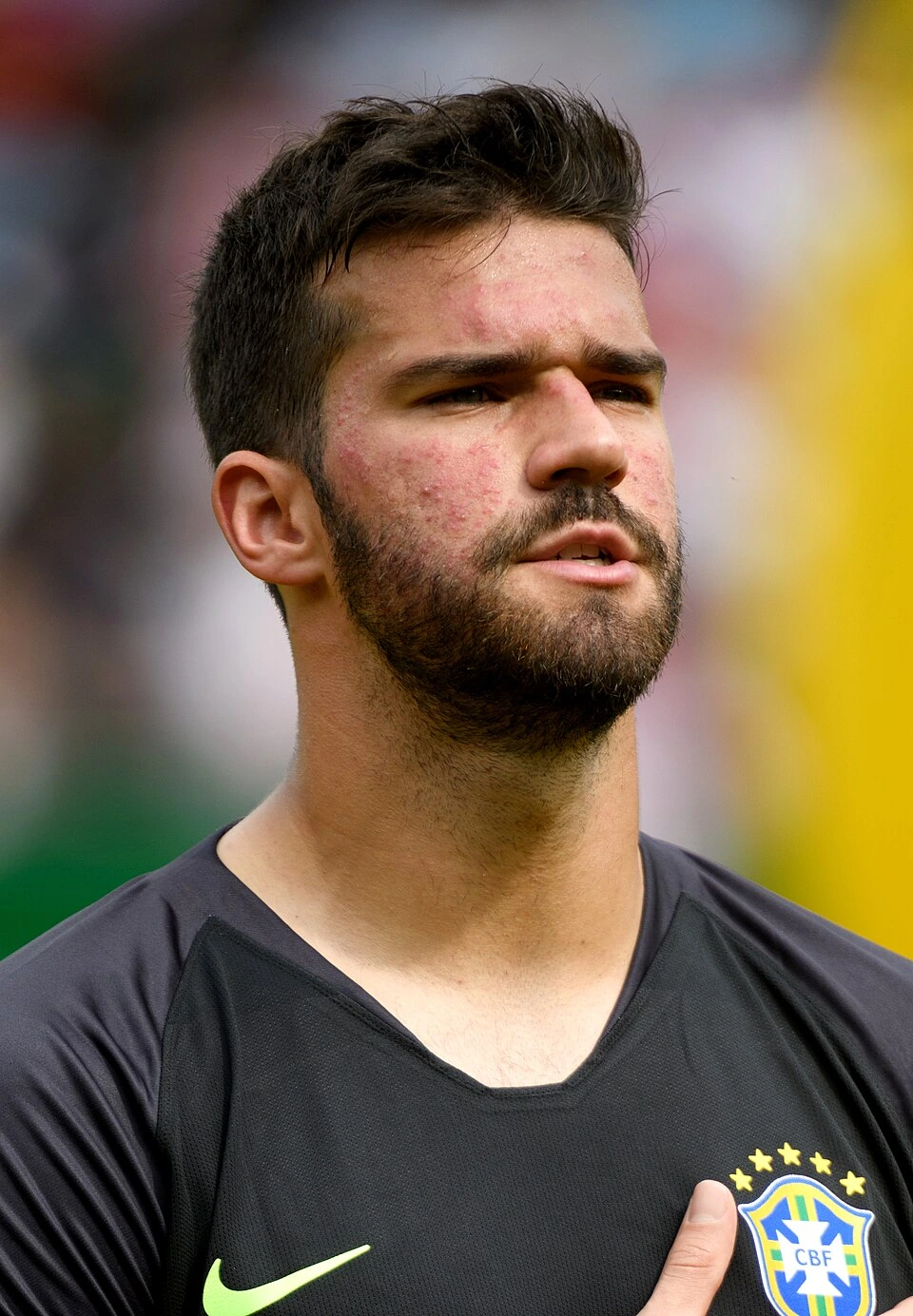 Alisson Becker in a Brazil national team kit during an on-field moment, close-up portrait