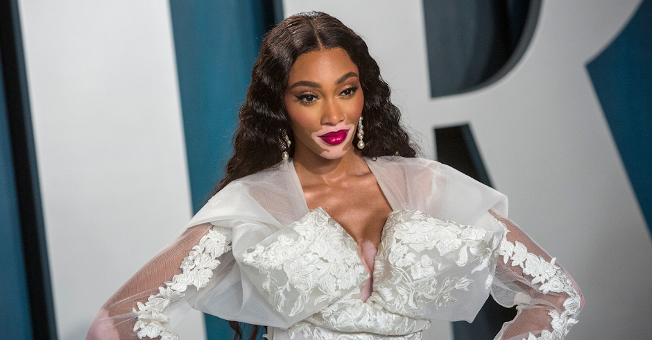 Winnie Harlow Oscars 2020 | Chris Ashford/Camera Press/picturedesk.com