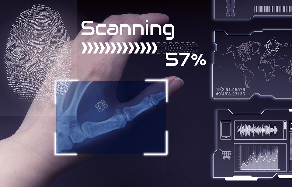 Röntgenaufnahme von einer Hand mit einem Chip, der unter die Haut implantiert ist.