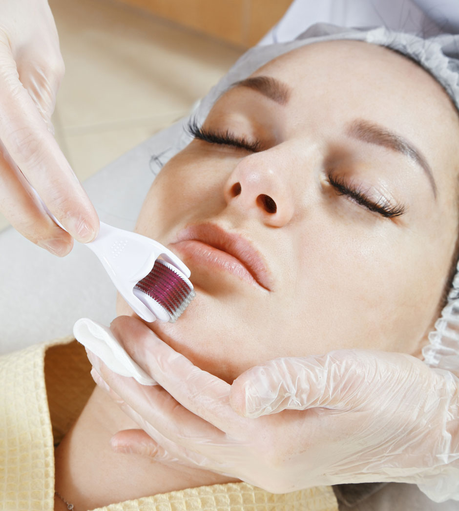 Frau bei einer Microneedling-Behandlung | Credit: iStock.com/ForsterForest