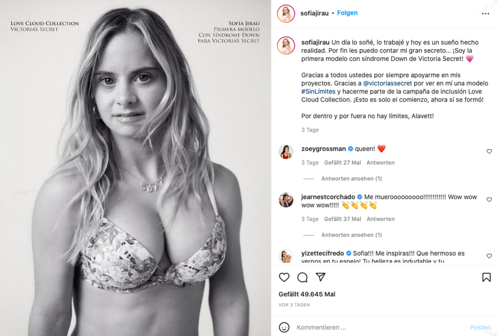 Victoria's Secret engagiert erstmals ein Model mit Down-Syndrom