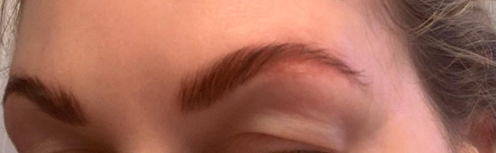 Augenbrauen nach dem Lifting I Credit: weekend.at