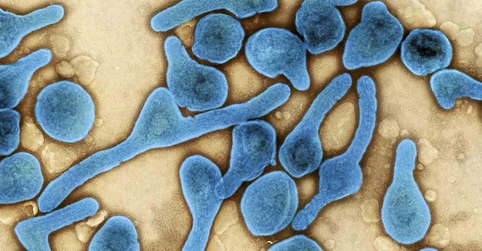 Das Marburg-Virus unter dem Mikroskop