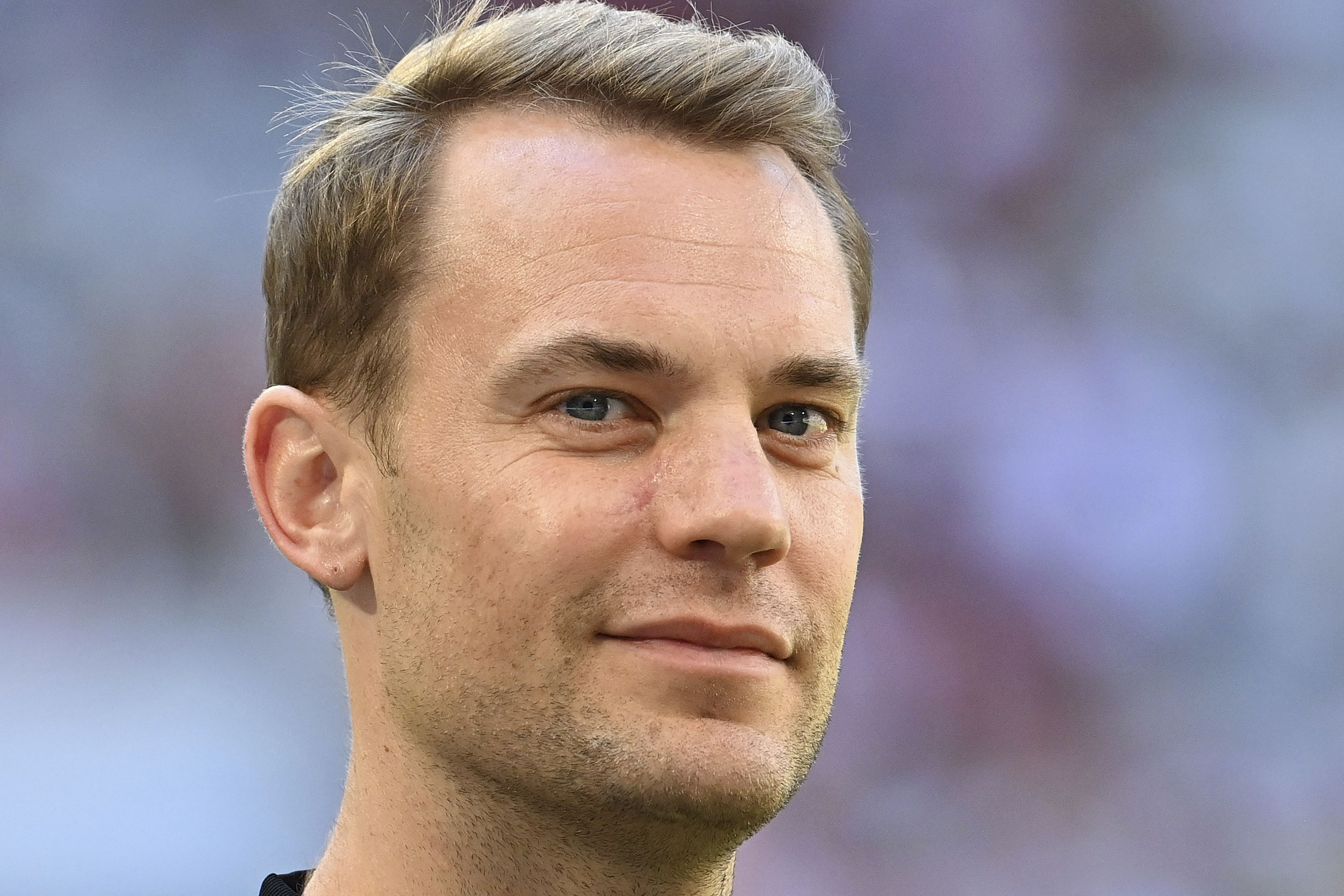 Torhüter Manuel Neuer zeigt seine Narbe unter dem rechten Auge, die eine Folge seiner Hautkrebs-Erkrankung ist