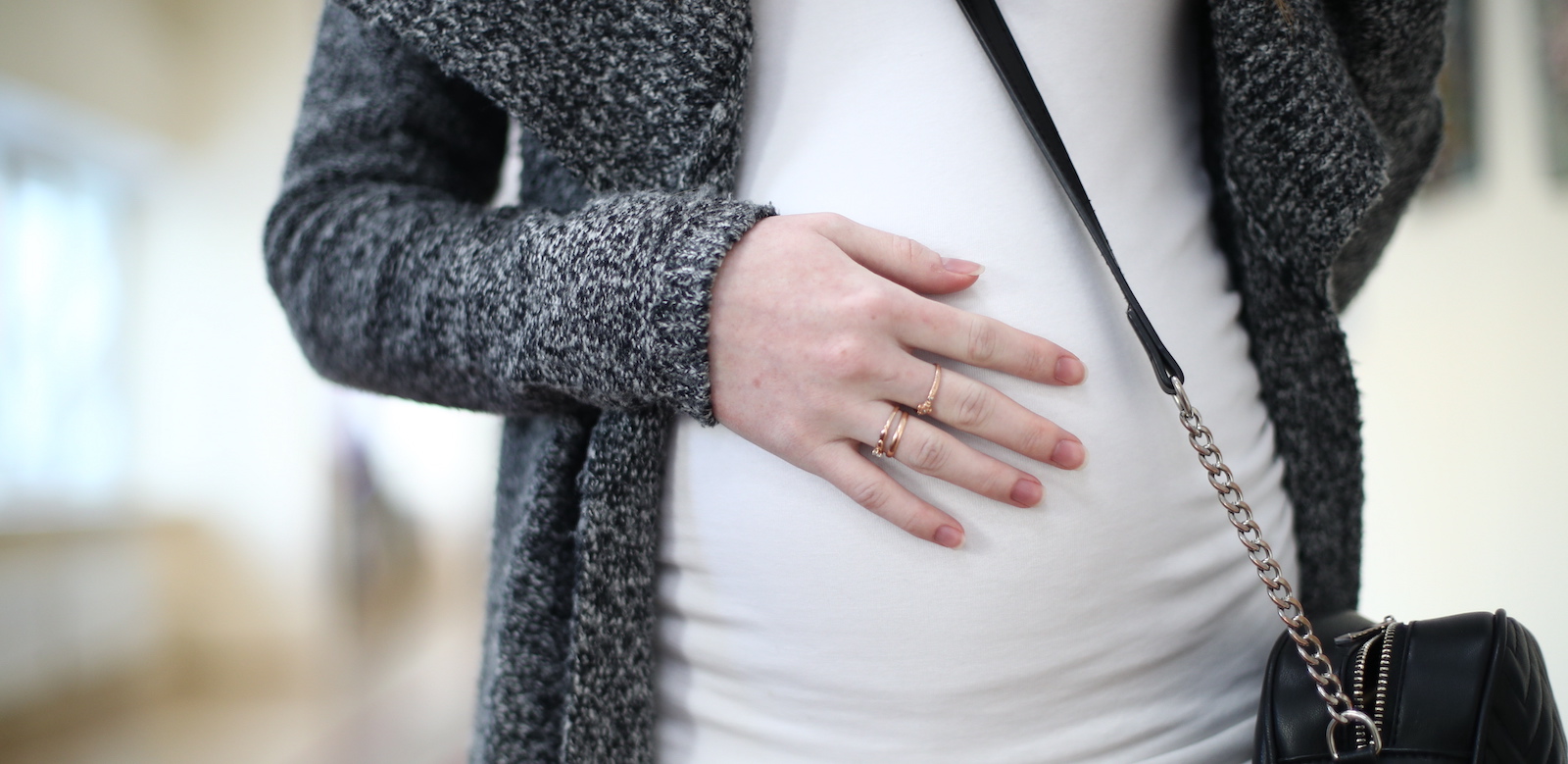 Schwangere Russinnen | Credit: Mikhail Tereshchenko / Tass / picturedesk.com