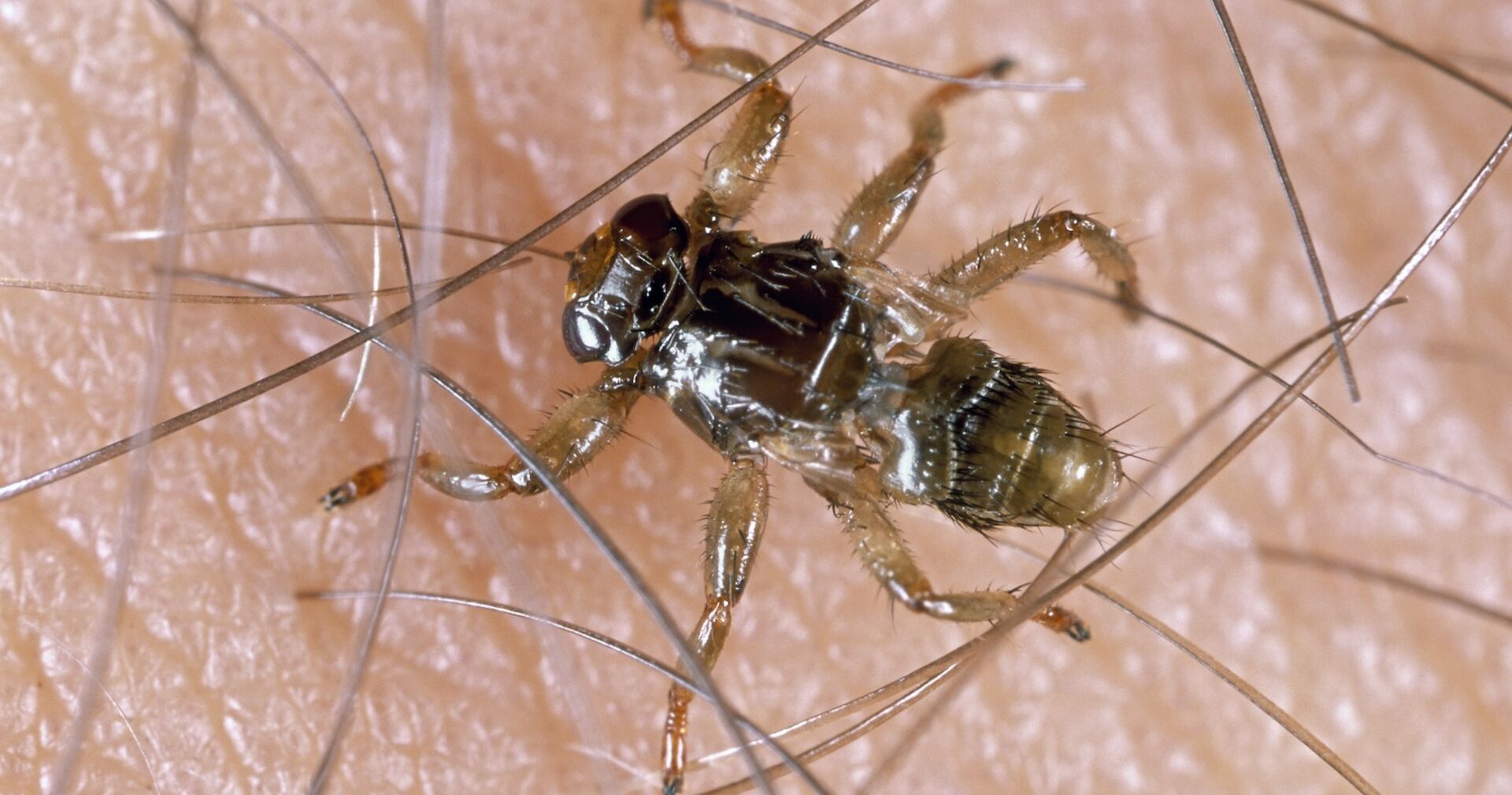 Eine Hirschlausfliege auf der Haut.