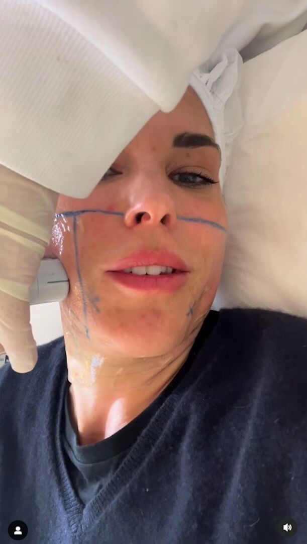 Elke Rock mit einer Bemalung im Gesicht beim Beauty-Doc.