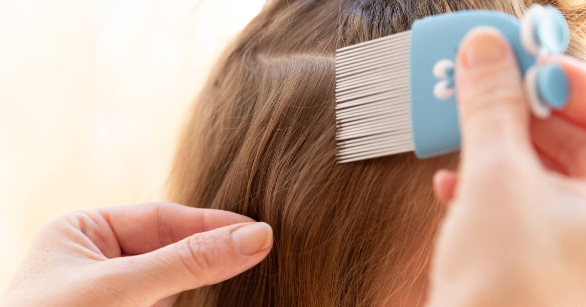 Kind, dessen Kopf mit einem feinzinkigen Kamm gegen Kopfläuse gekämmt wird.