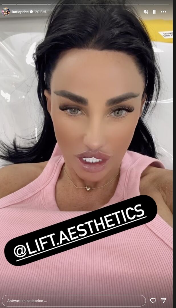 Ein Screenshot von Katie Price aufgespritzten Lippen.