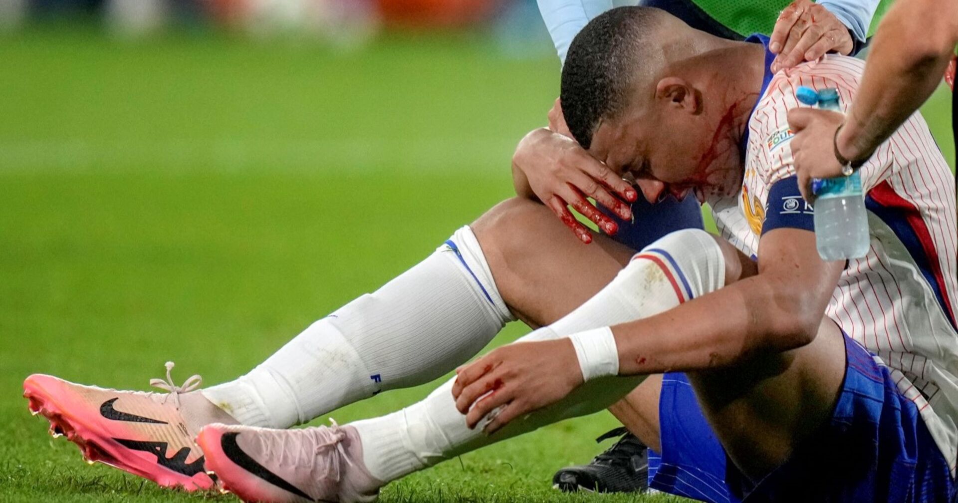 Mbappe sitzt am Rasen, den Kopf zwischen den Beinen und die Nase haltend. Er blutet. Helfer reichen ihm Wasser.