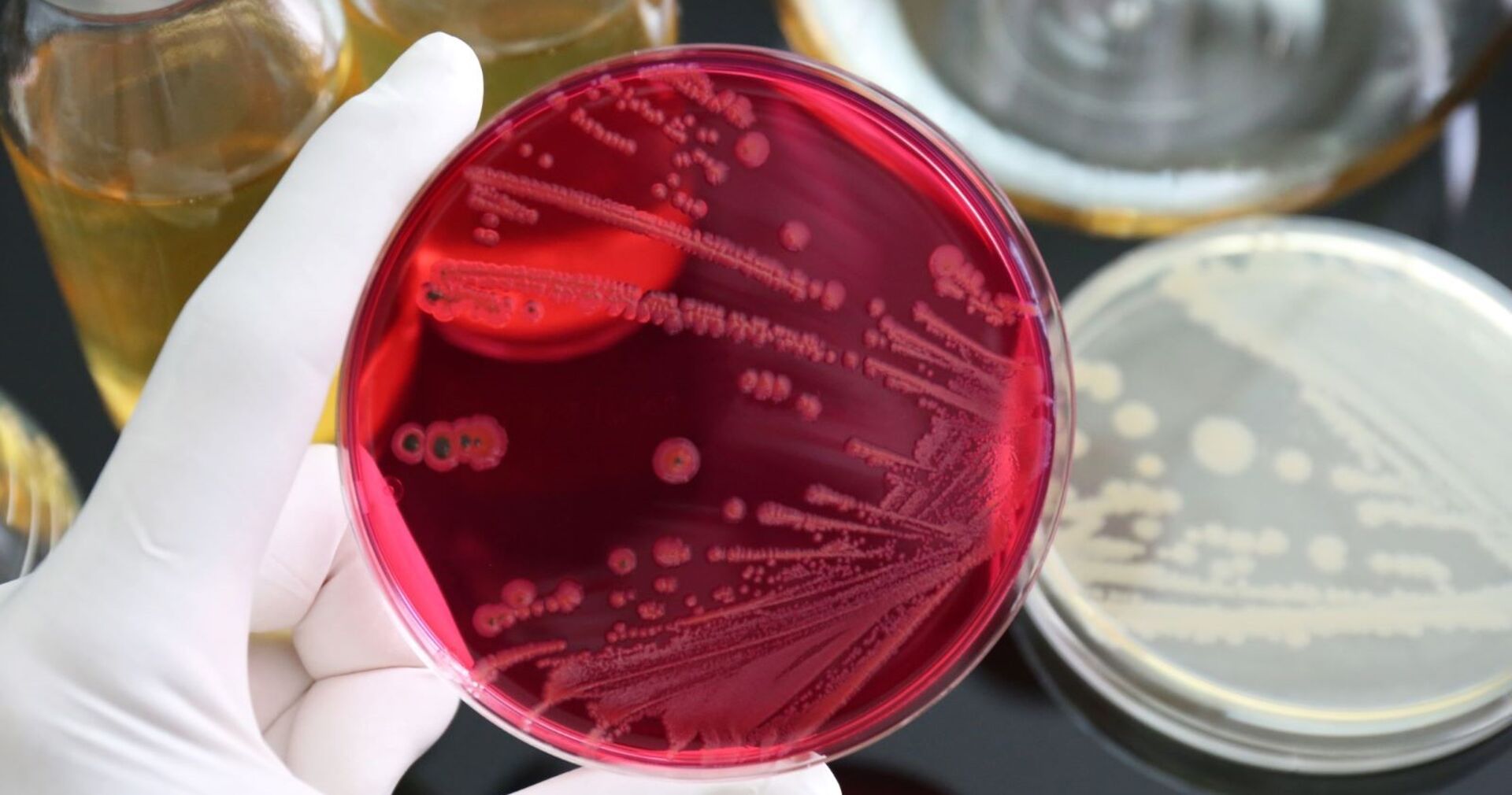Salmonellen in einem Labor-Reagenzglas.
