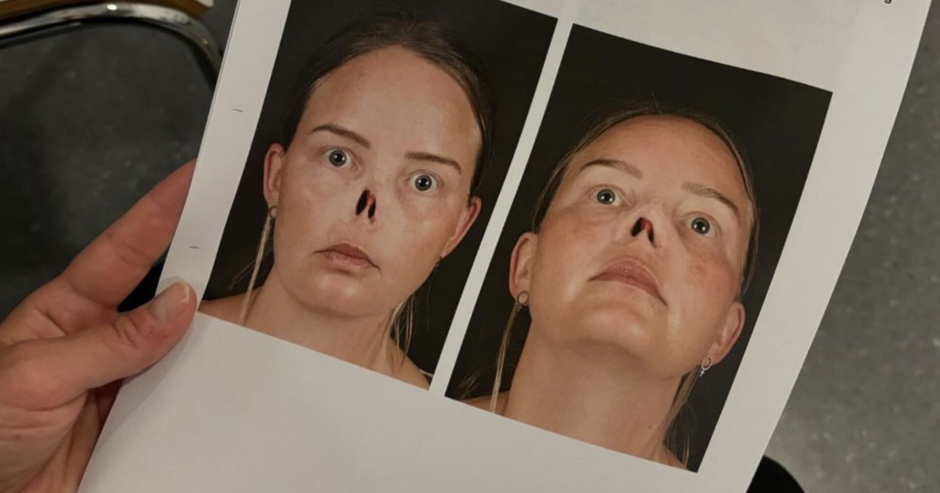 Bilder von Charlotta Oskarsson ohne Nase.