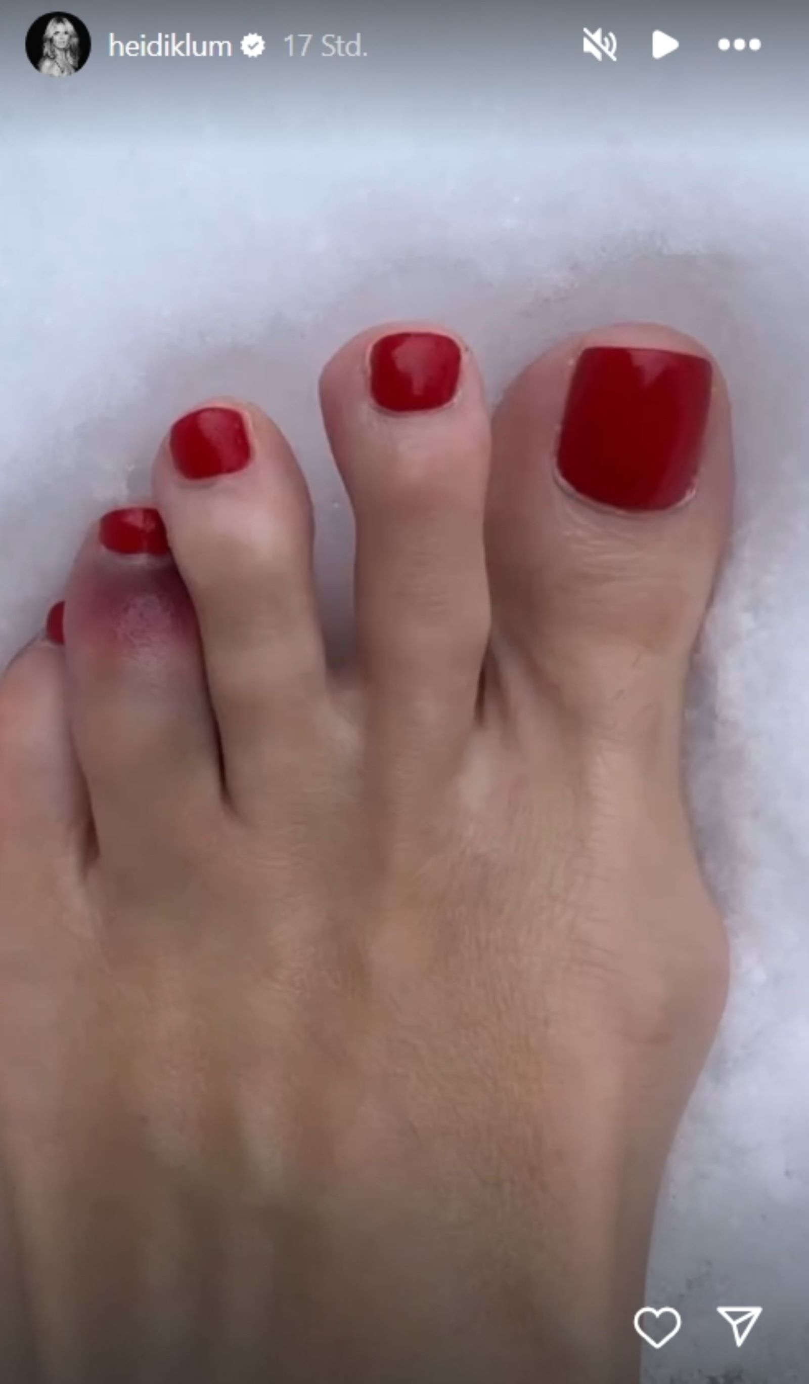 Der blaue Zeh von Heidi Klum.