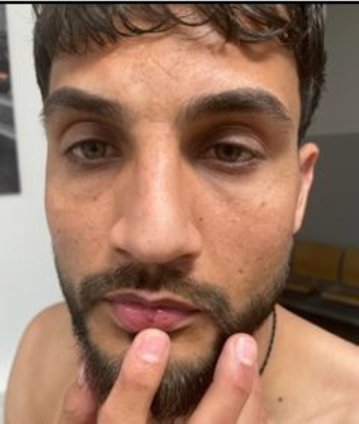 Fahndungsfoto: Mann mit Bart