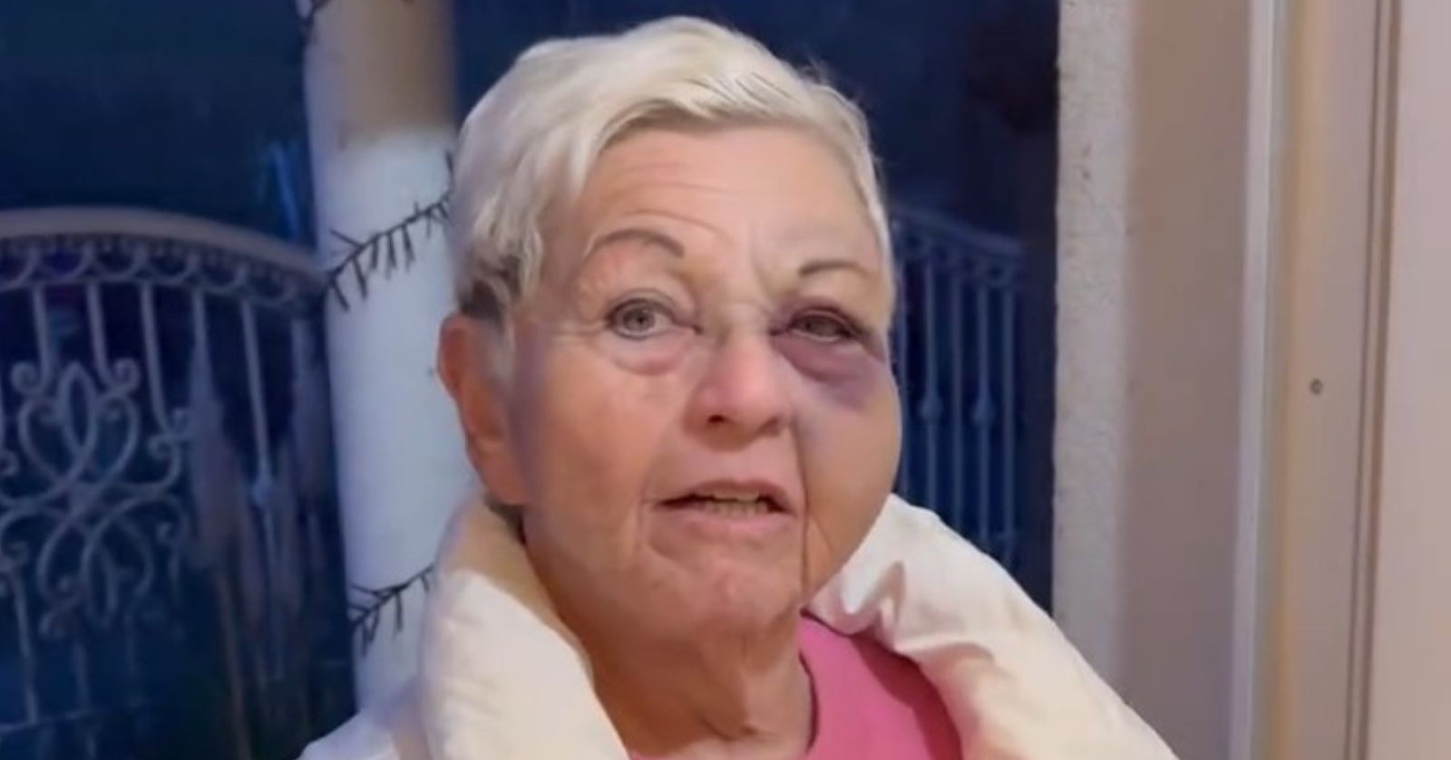 Jazz Gitti mit blauem Auge