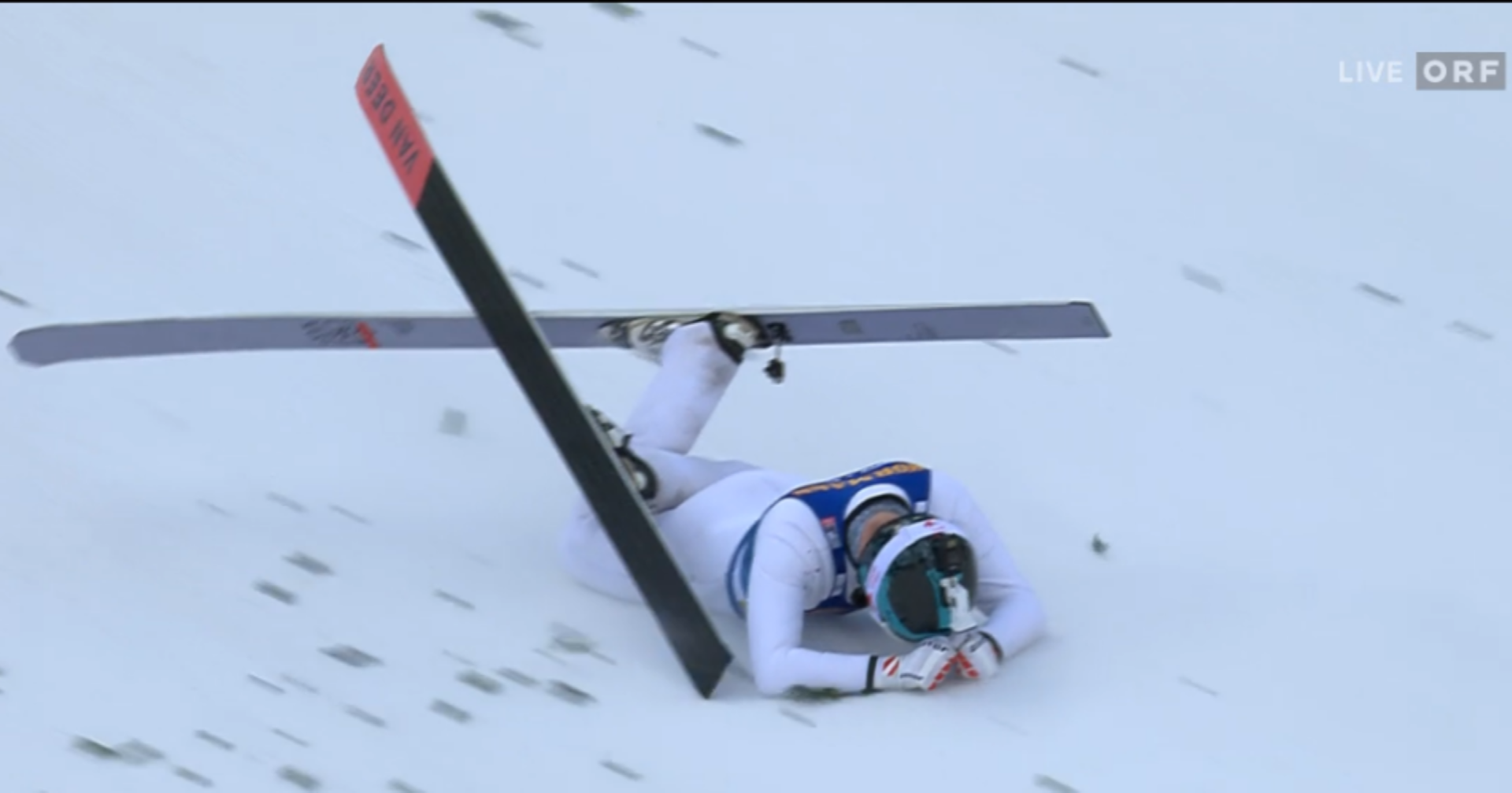Liensher ist beim Kamerasprung gestürzt und auf das Gesicht gefallen.