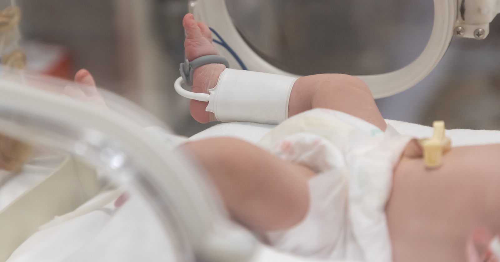 Der zwei Monate Bub wird in Wiener Neustadt behandelt, ein Sachverständiger soll die Ursache der Rippenbrüche klären.