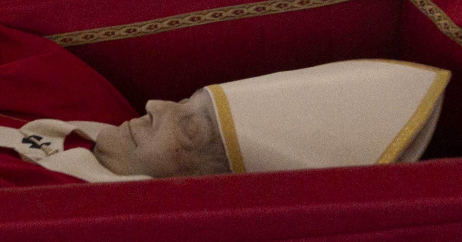 Nahaufnahme des Gesichts von Papst Franziskus im Sarg, mit deutlich sichtbaren dunklen Flecken an der linken Stirnseite.