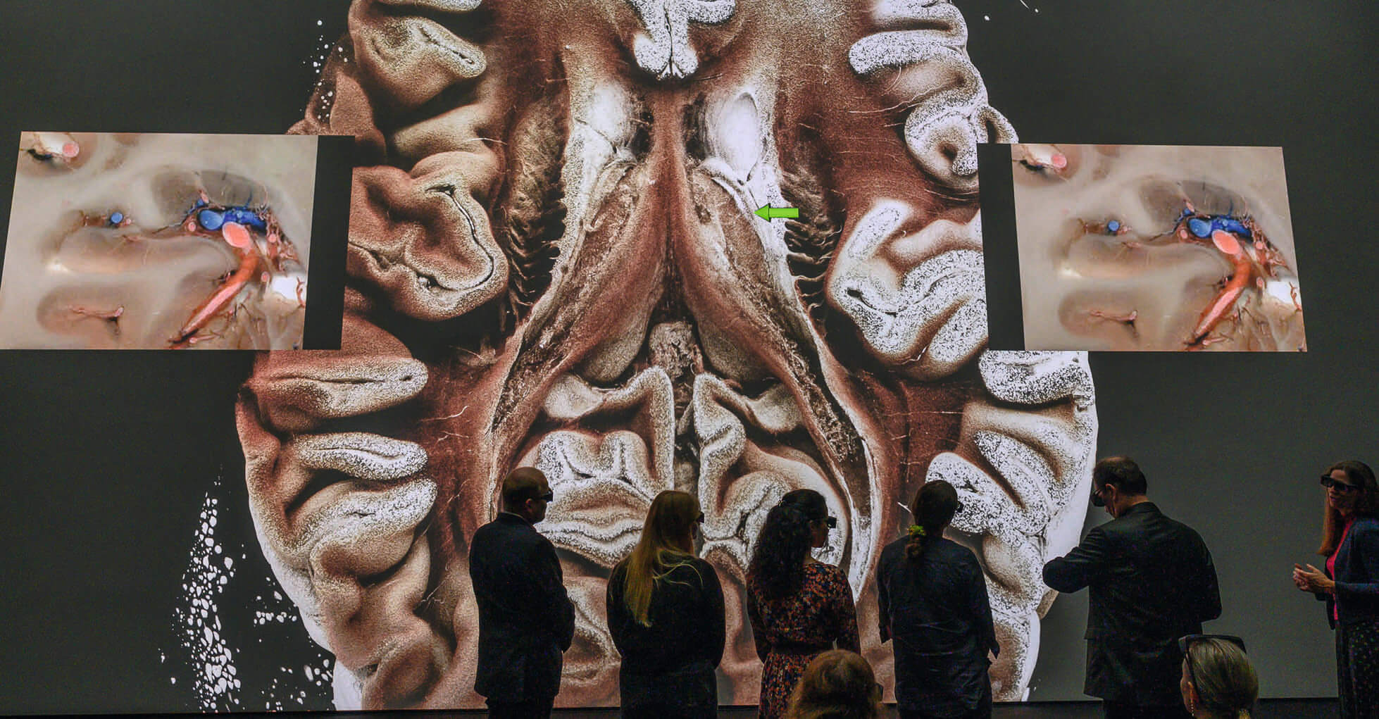 Im JKU medSPACE können Organe mittels 3D-Brillen studiert werden.