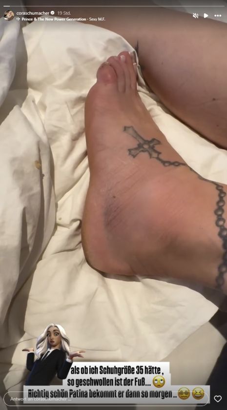 Cora Schumachers geschwollener Fuß