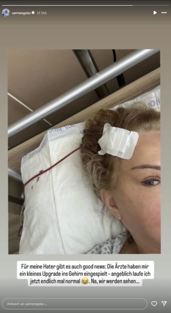 Carmen Geiss mit einem Pflaster auf dem Kopf