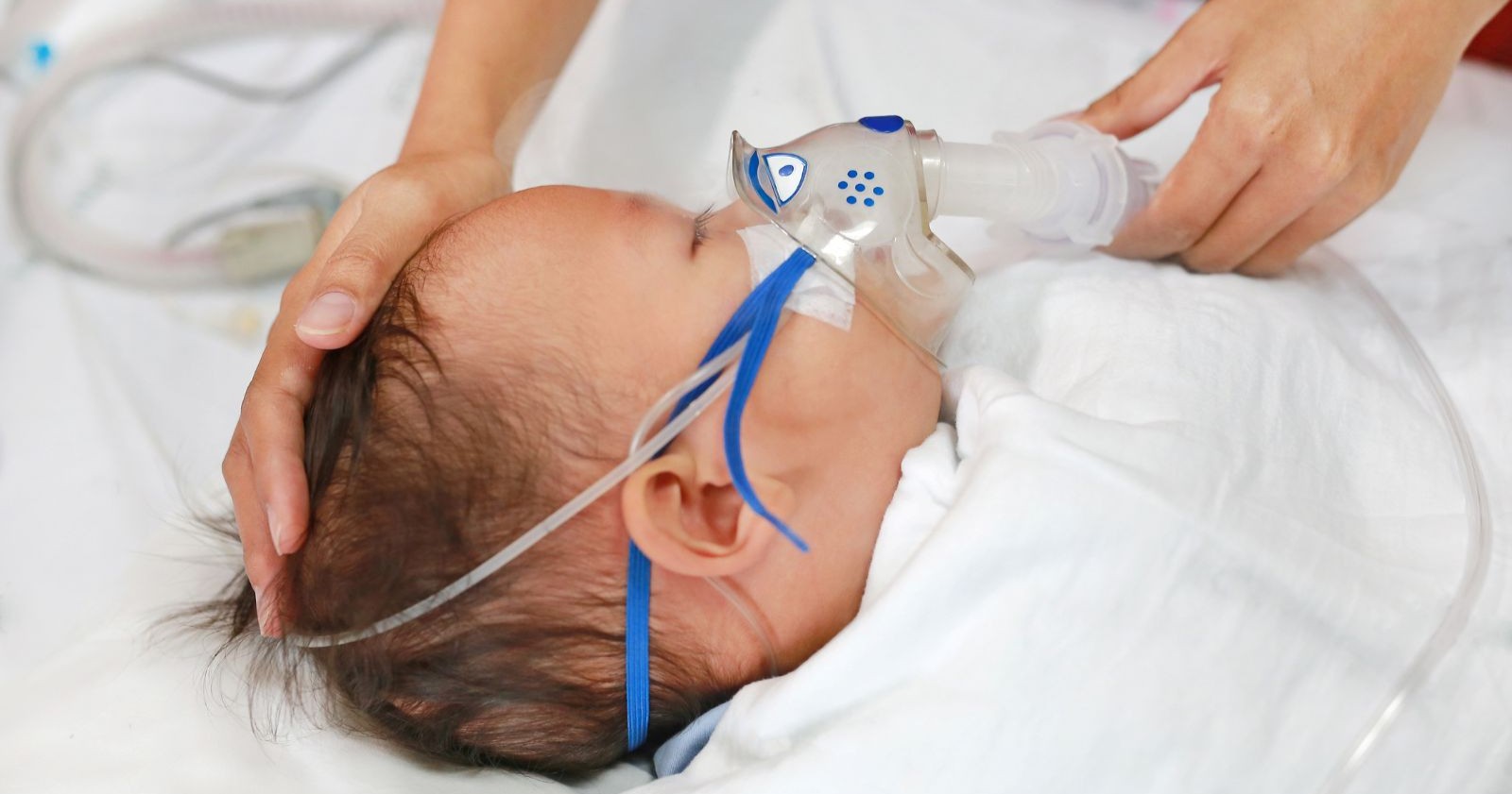 RKI alarmiert: Säugling wird mit Atemmaske im Krankenhausbett, behandelt wegen einer RSV-Infektion.