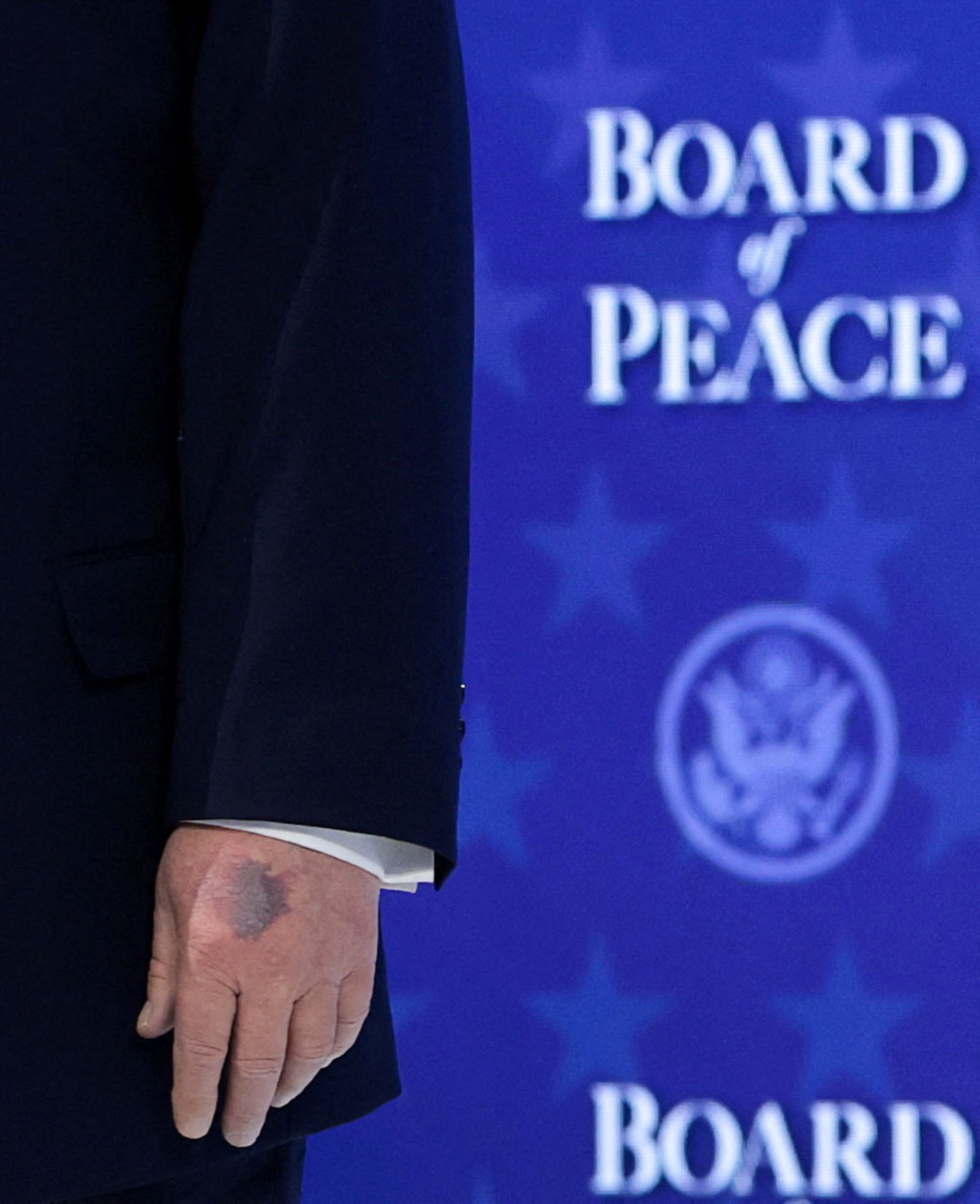 Nahaufnahme von Donald Trumps linker Hand mit sichtbarem blauen Fleck vor dem Hintergrund des Schriftzugs „Board of Peace“ beim Weltwirtschaftsforum in Davos.
