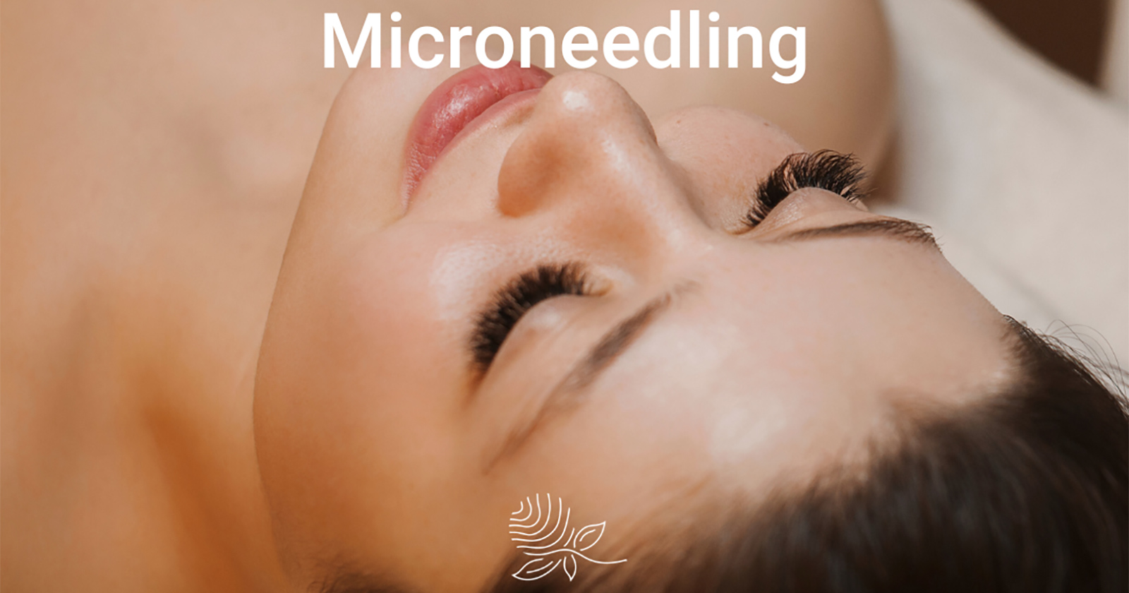 Frau nach einer erfolgreichen Microneedling-Behandlung | Credit: Individual Beauty
