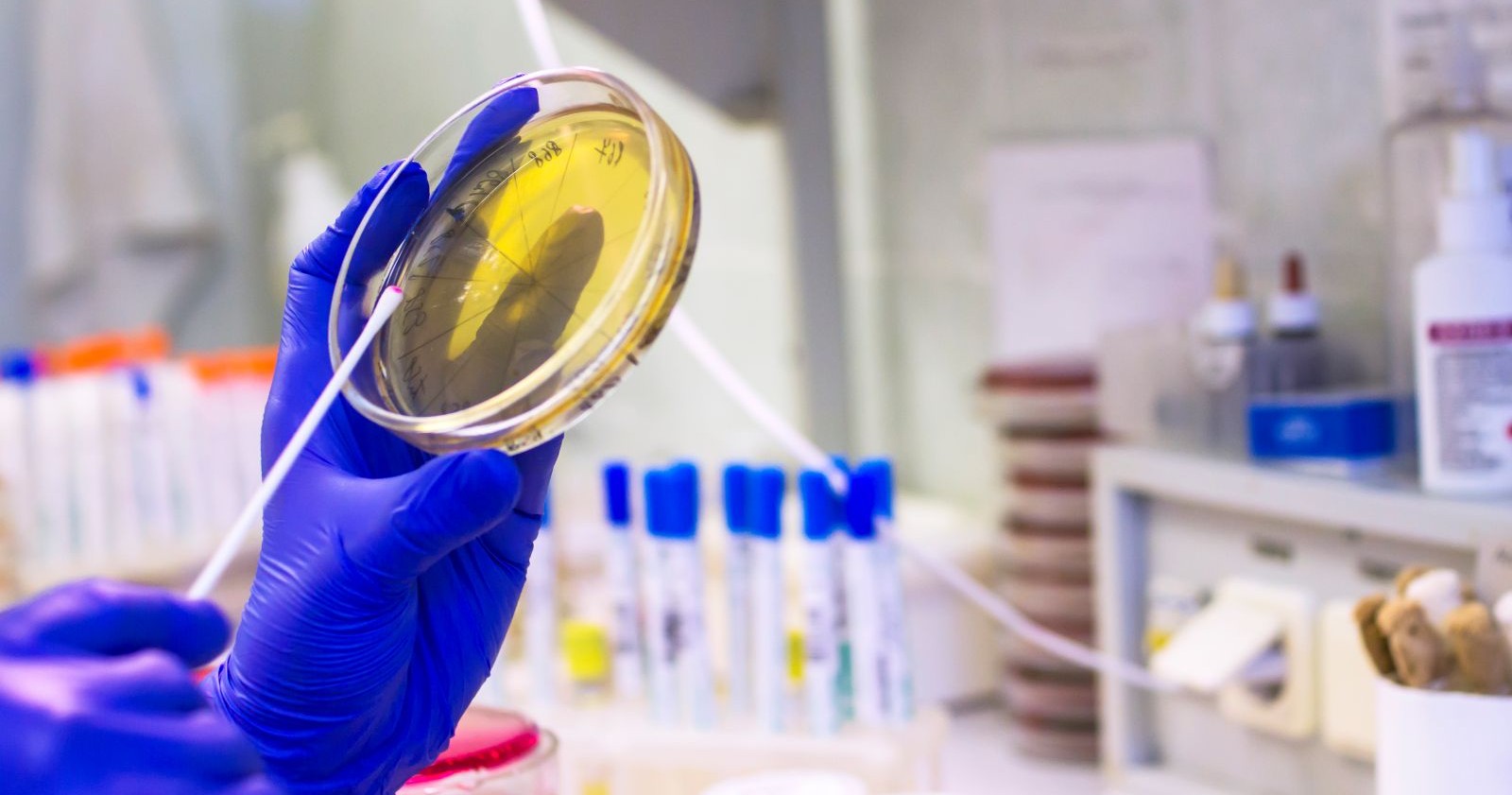 Babynahrung steht wegen möglicher Cereulid-Belastung weltweit unter Beobachtung.