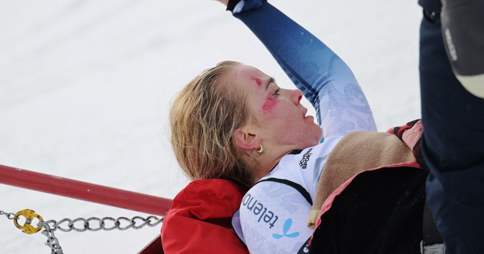 Skirennfahrerin Marte Monsen nach ihrem Sturz in Crans-Montana mit Schürfwunden im Gesicht