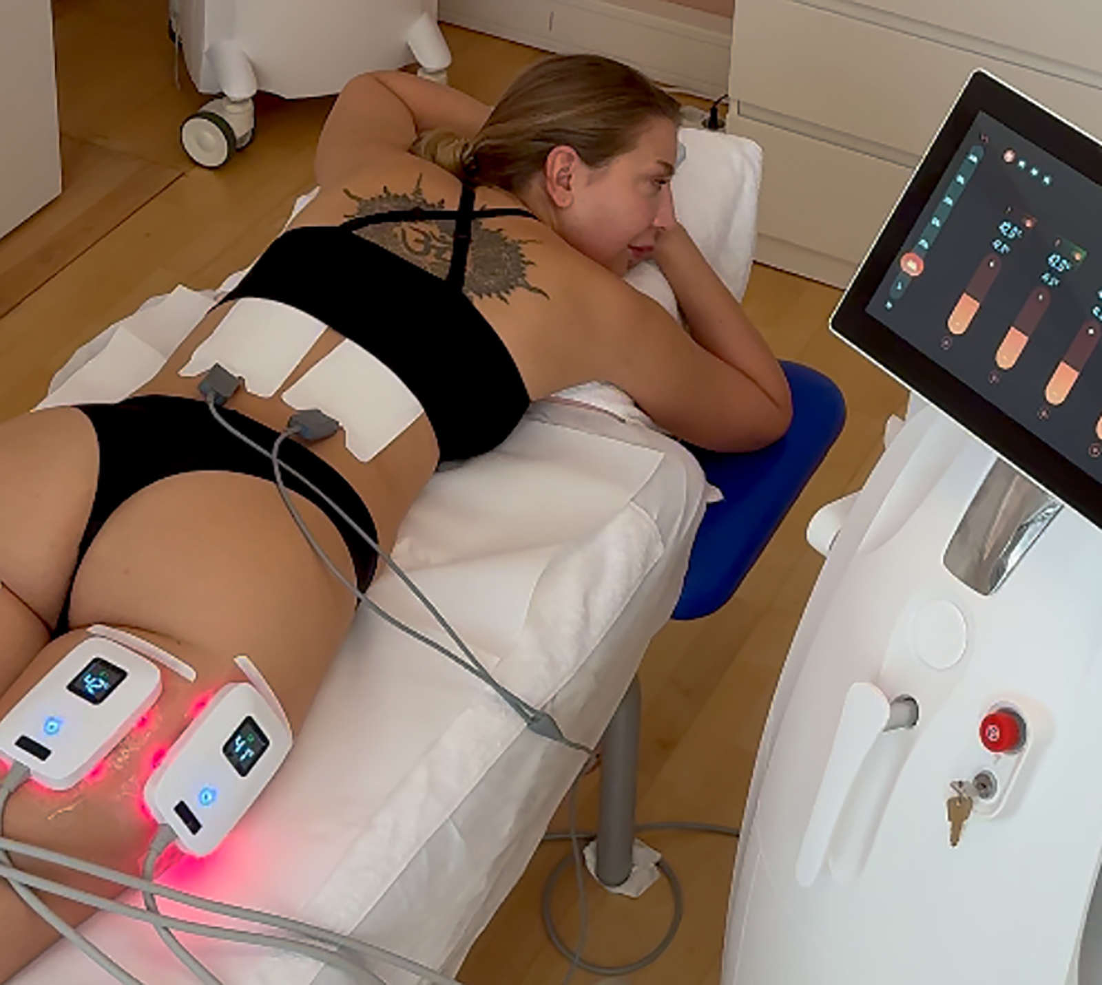 Frau bei Fettpölsterchen-Behandlung | Credit: Individual Beauty