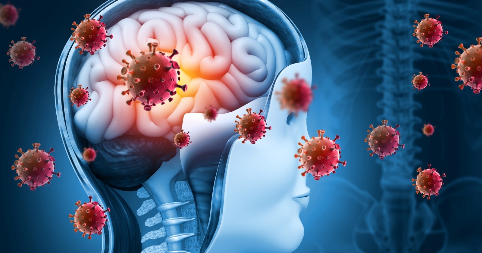 Ein Meningitis-Ausbruch in England betrifft vor allem junge Menschen.