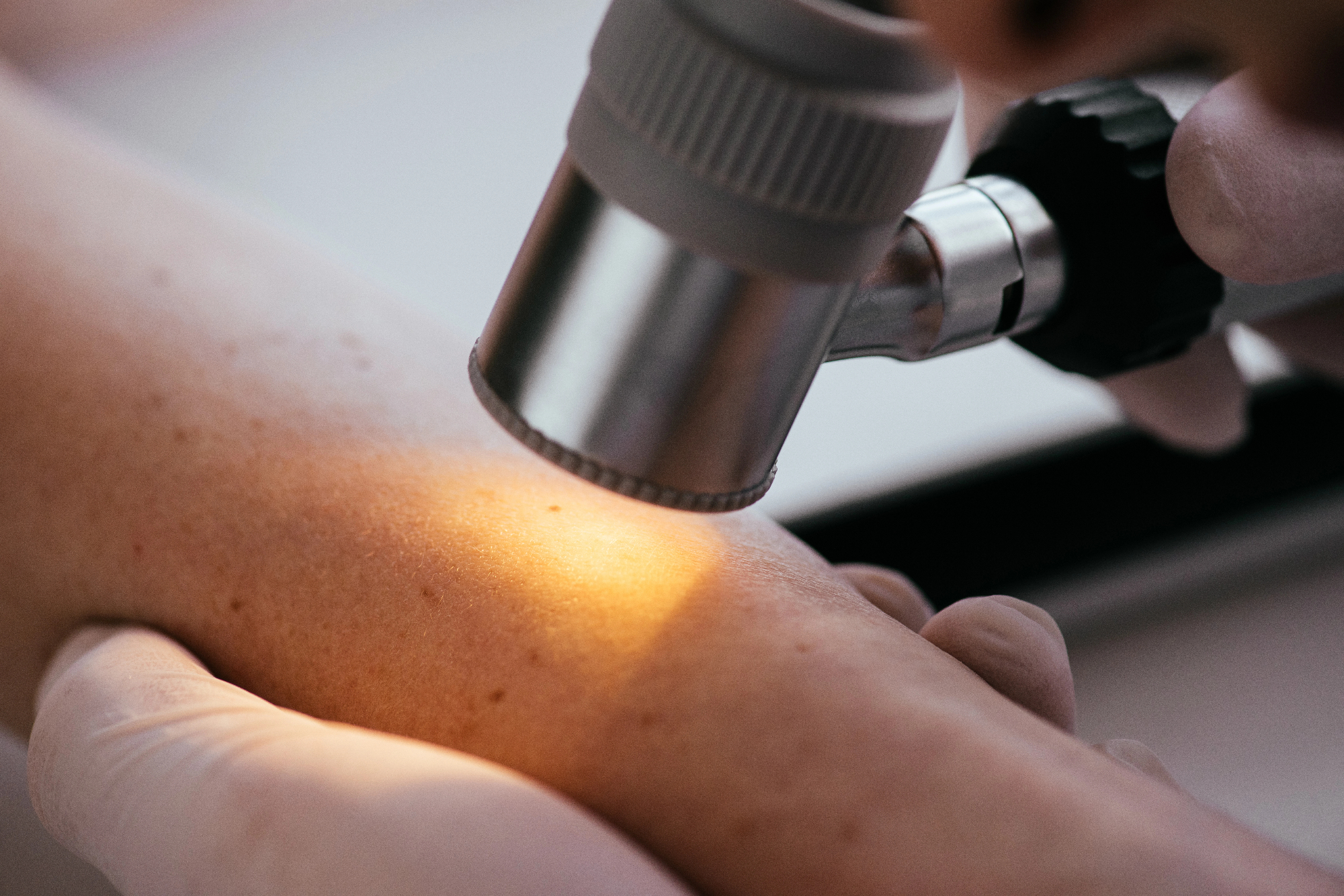 Danes je za zdravje in lepote kože dermatologija ključna